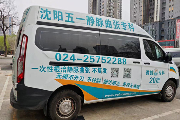 静脉曲张症状表现有哪些?沈阳血管病医院教你如何治疗静脉曲张！