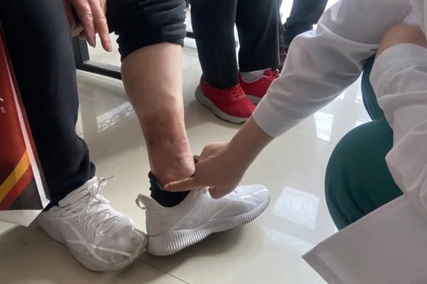 从病因识别到日常管理：大连下肢静脉曲张规范化治疗与生活方式干预的综合管理路径