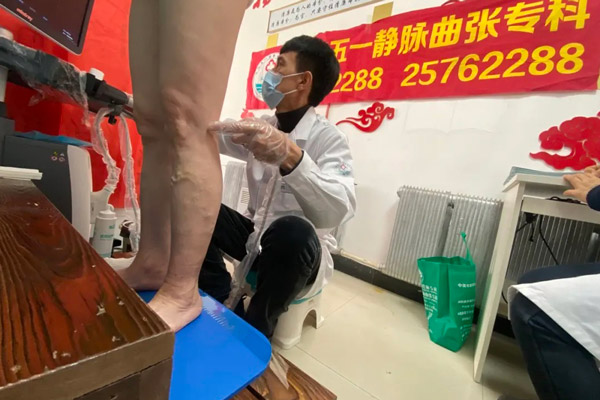 沈阳下肢静脉曲张的症状识别与早期诊断：如何在家中进行自我评估与及时就医