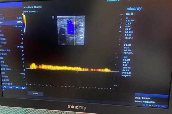 下肢静脉曲张（蚯蚓腿），沈阳静脉曲张专科医院五一静脉曲张专科带您全面了解下肢静脉曲张的诊断与治疗